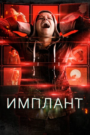 Имплант в hd качестве